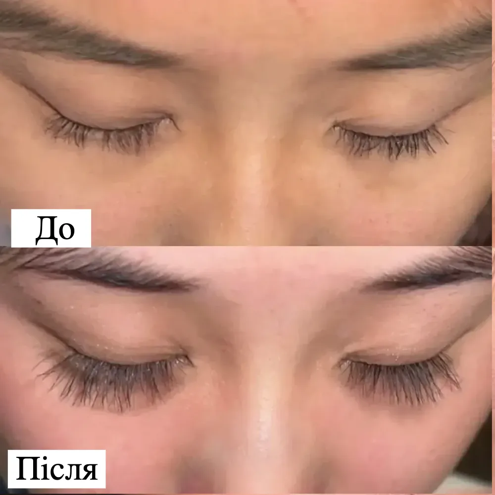 Eyelash Growth Serum shop